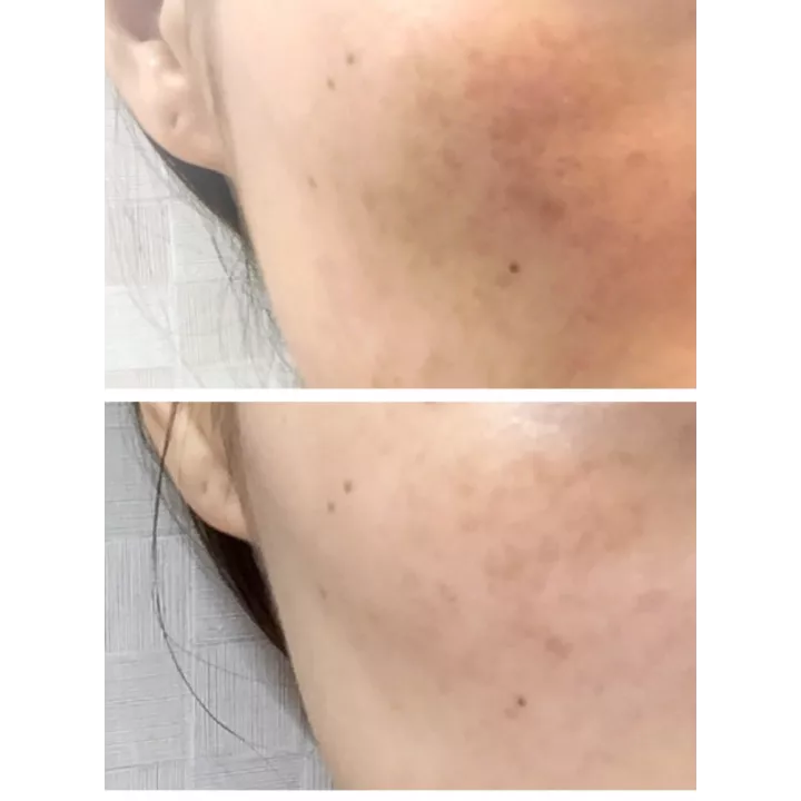 SK-II - Esencia Genoptics Aura | Rose Kaori